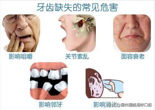 国家对种植牙最新政策解读与解析